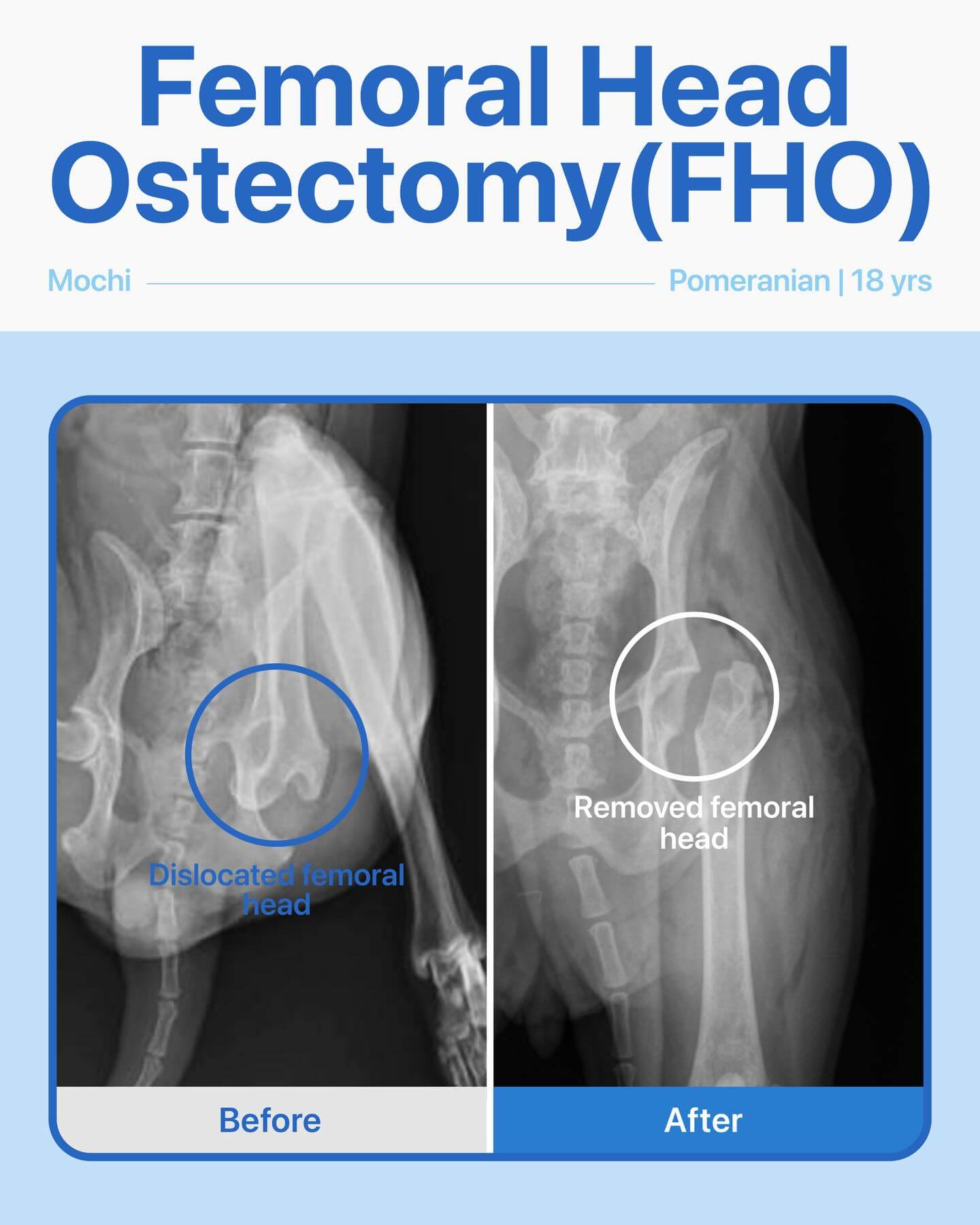Femoral Head Ostectomy – Mochi