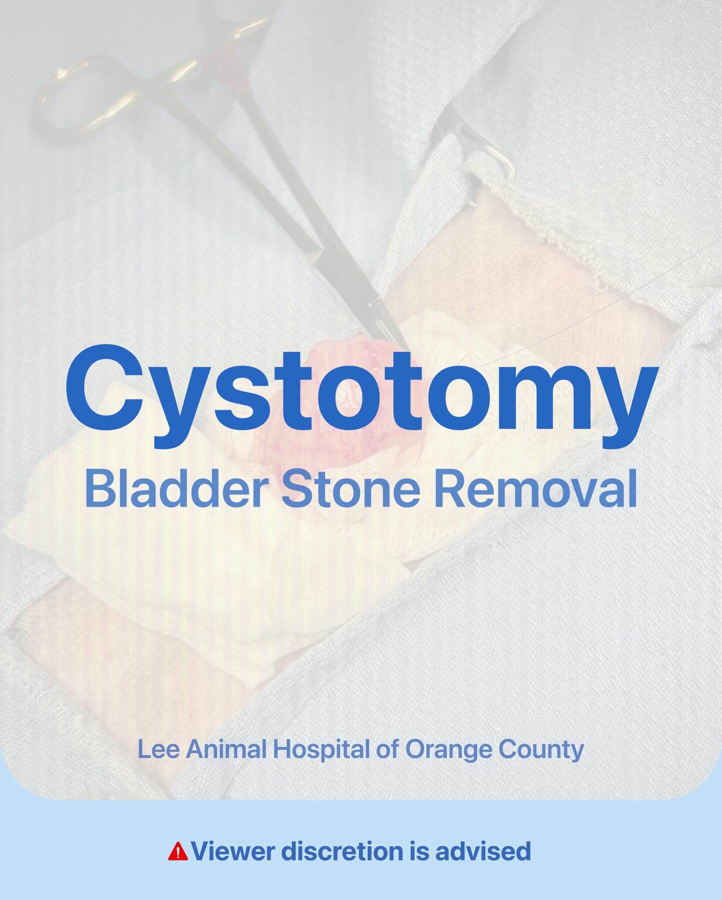 Cystotomy – Anonymous  