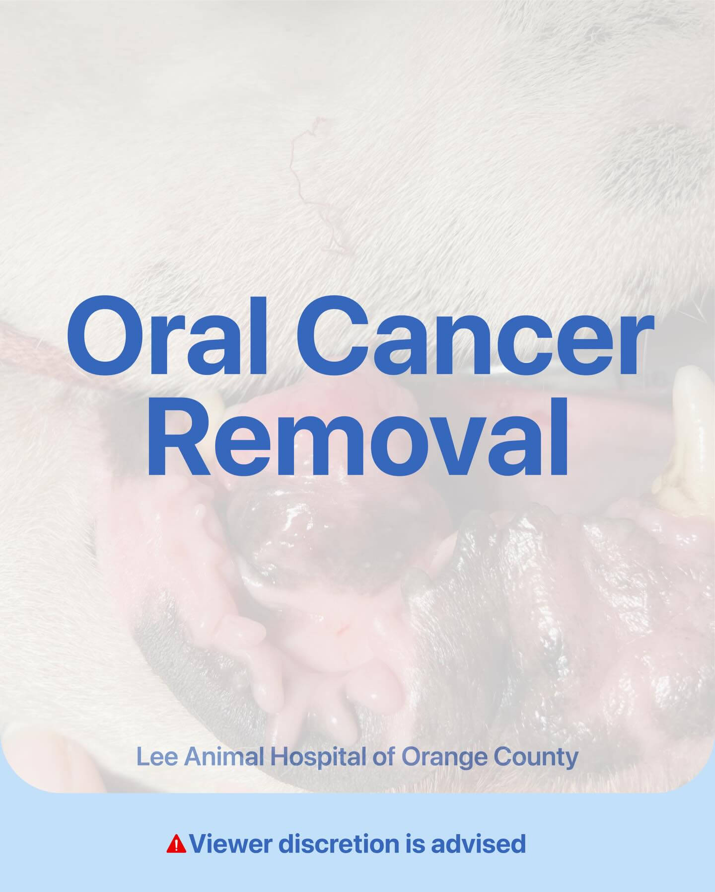 Oral Cancer Mass Removal – Anonymous