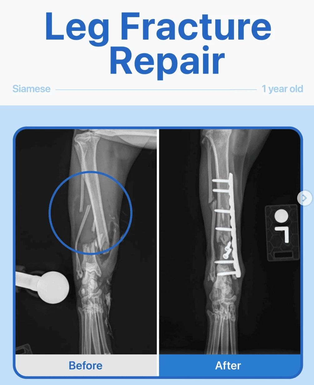 Leg Fracture Repair – Siamese